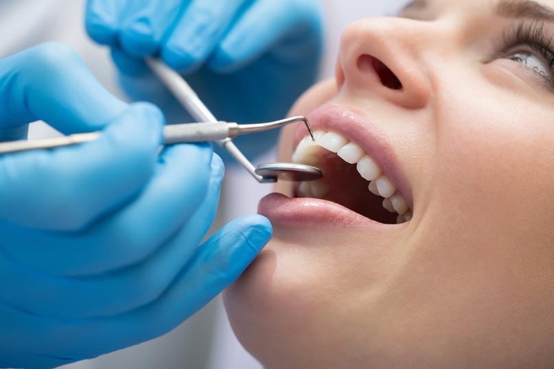 Как часто стоит посещать стоматолога?