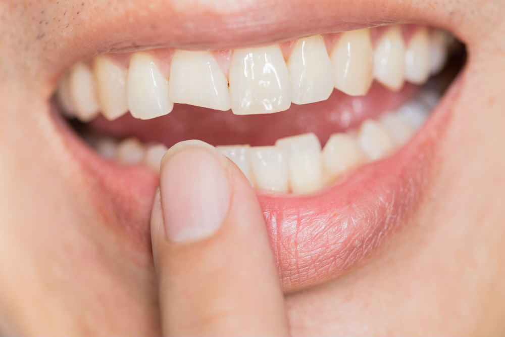 Пломбирование и реставрация зубов - в чем разница?