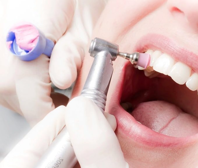 Что такое СПА-процедуры для полости рта
