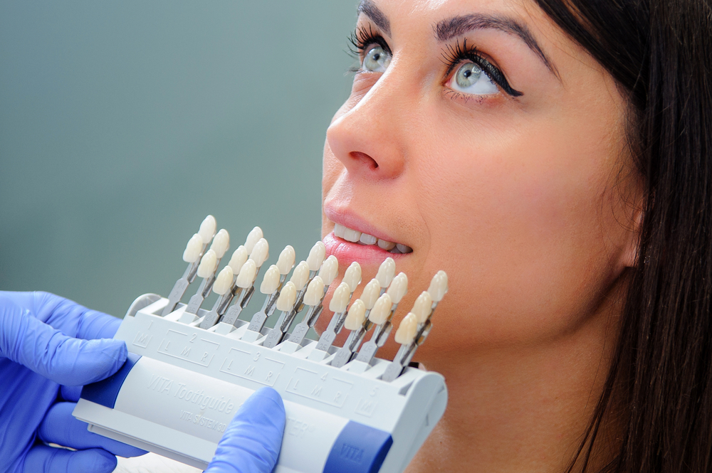 Насколько безопасно отбеливание зубов?