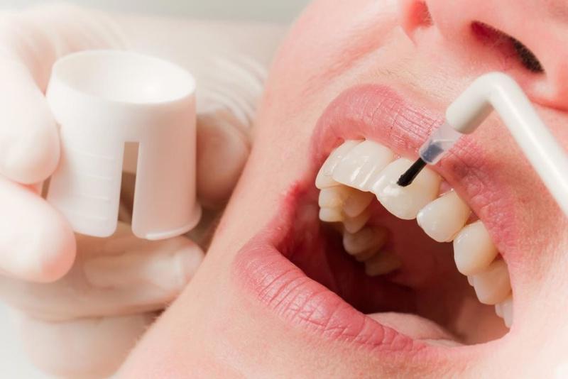 Покрытие зубов фторлаком Томск Восточный томск стоматология стома
